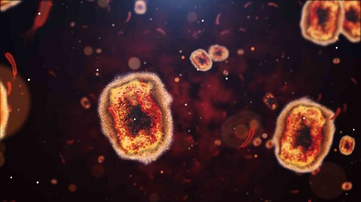 San Diego County Declares Monkeypox a Public Health Emergency, Following California's Lead