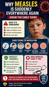 🚨 Measles Is Spreading Again — 6 Early Signs You Should Know