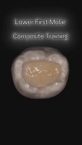 Cl. I Cusp by Cusp 💫 #dentist #dentistry #dentalschool | Dental Art