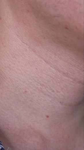 With this base makeup, it's easy for me to put on makeup.🫶🏻🫶🏻#foryou #fyp #Makeup #foundation #Concealer