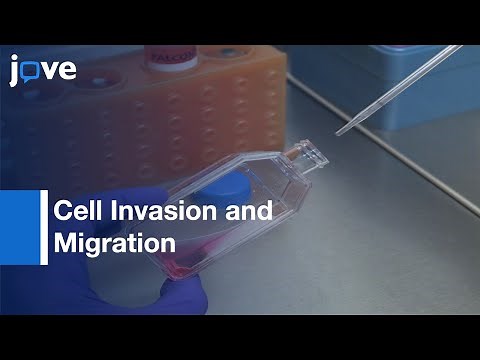 Scratch Wound Assay and Boyden Chamber Assay Comparison | Protocol Preview
