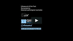 Musculoskeletal Ultrasound - Foot
