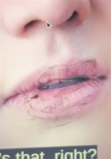 Why Actors Suffer from Dry Lips: Causes and Solutions