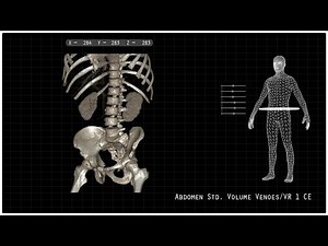 Abdomen CT