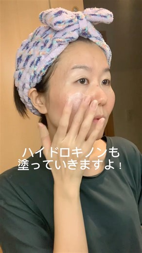トレチノイン&ハイドロキノン療法14日目#トレチノイン #ハイドロキノン #tretinoincream #skincare #ニキビ跡
