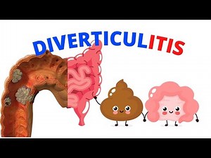 What is Diverticulitis? A Brief Overview, causes and Treatment.