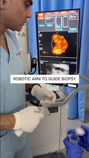 MRI fusion prostate biopsy in cancer prostate #prostatecancer #prostatedisease