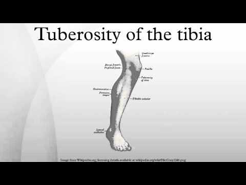 Tuberosity of the tibia