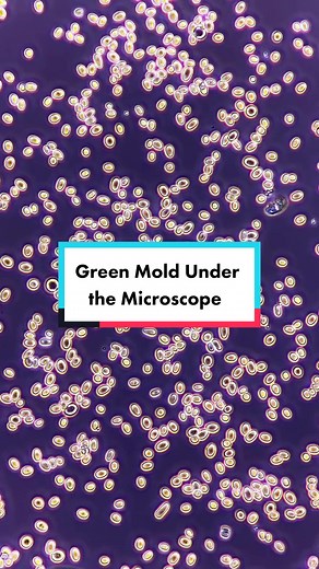 Exploring Green Mold - Penicillium Digitatum Under the Microscope
