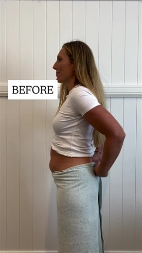 Beneficios de los Colonics: Antes y Después 😌✨