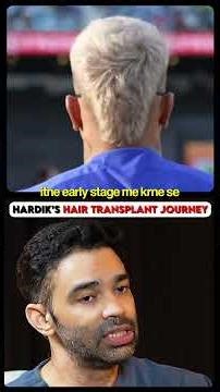 Hardik Pandya's Hair Transplant Journey! #hardikpandya #hairloss #treatment #cricket