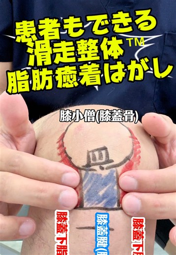 膝蓋下脂肪体の癒着とは？膝の痛みが変わる改善法（滑走整体）