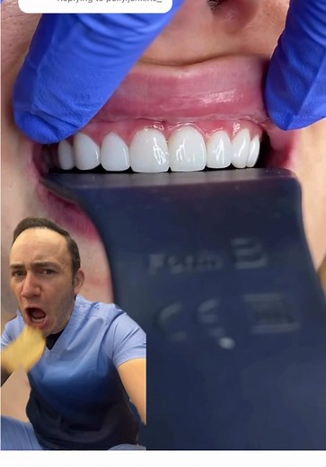 Carillas dentales: tratamientos y consideraciones importantes
