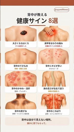 背中が教える健康サイン8選🔎大きくなるほくろは要注意 #shorts #健康