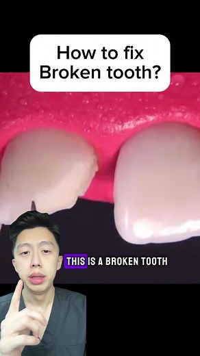 How to Restore Broken Teeth: A Step-by-Step Guide