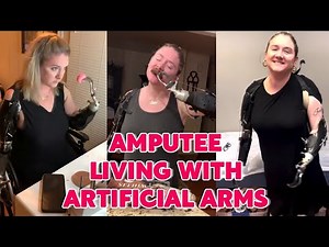 Amputee Lady Life After Amputation: My Daily Living Using Prosthetic Arms