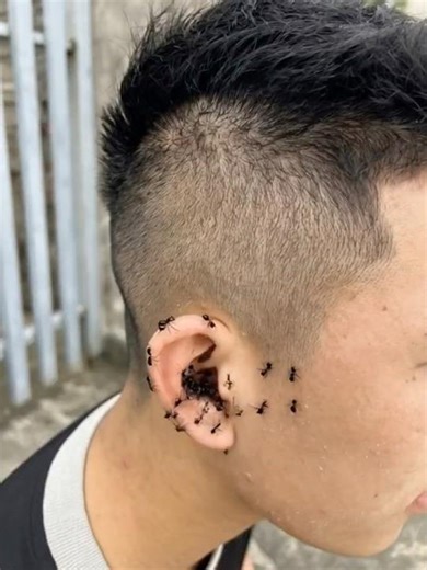 “Black Ants Crawled Into His Ear While Sleeping… 😨’'#couple #magic #shortsfeed