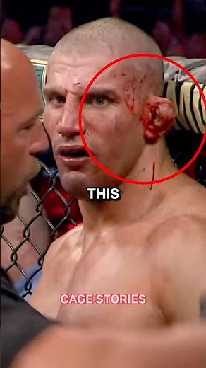 This UFC fighter ear EXPLODED!😮