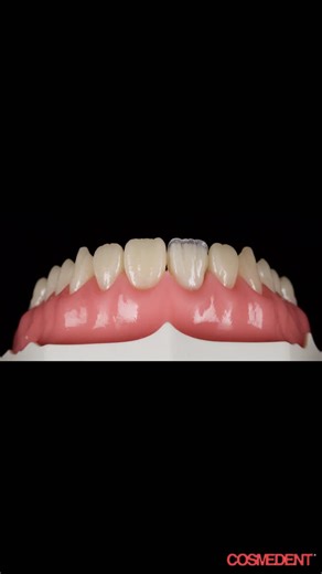 Cosmedent on Instagram: "Adult Tooth Typodont⁠ by @drjasonsmithson ⁠ Perfect your restorative skills with a high-quality adult tooth typodont designed for hands-on dental training. Ideal for students and clinicians looking to practice real-world restorative techniques with confidence and precision.⁠ ⁠ ✔️ Realistic anatomy⁠ ✔️ Ideal for restorative & clinical practice⁠ ✔️ Trusted for professional dental education⁠ ⁠ 👉 Join Dr Jason’s Class Now! Link in BIO⁠ ⁠ #DentalEducation #Typodont #Restorat
