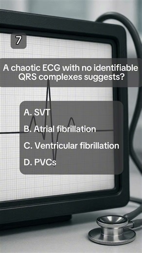 ECG Basics Explained | Anatomy Quiz: Cardiac Rhythms #quiz #quiztime