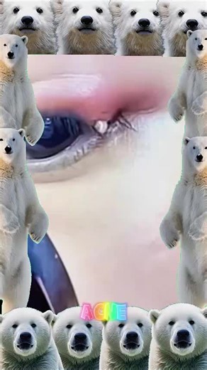 Satisfying Pimple Popping Video Compilation