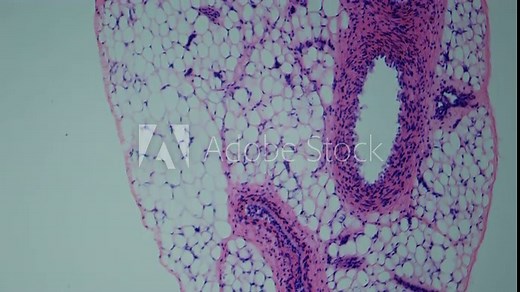 Angiology Lab. Examination of the cross section of vessels. Veins and arteries under the microscope. Magnification of 100 times