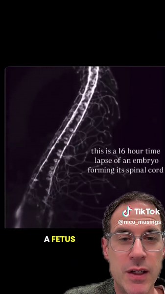 Spinal Cord Development in Newborns: 16-Hour Journey