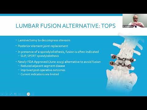 Dr. Joshua Marcus - TOPS™ System Webinar