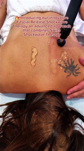 🔥 Introducing our innovative Fascial Release Shockwave Therapy