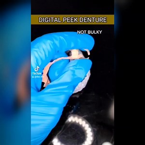 13K views · 198 reactions | DIGITAL PEEK DENTURES are fabricated...