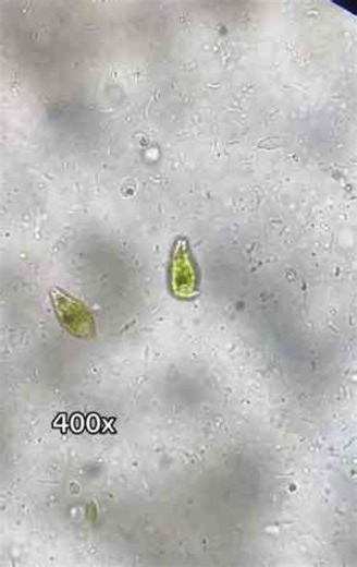 Two tiny microbes up close, microscopic friends revealed