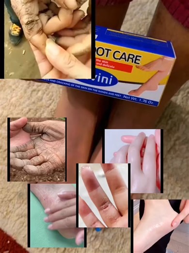 3 #Aavini#intensive#footcare#fypシ゚viral #tiktokshop video viral#haitiantiktok🇭🇹 #usa🇺🇸