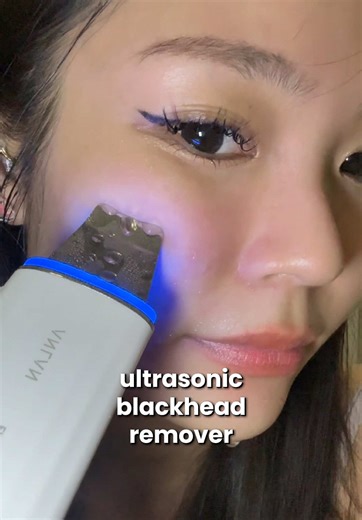 Effective Ultrasonic Blackhead Remover for Nose and Chin