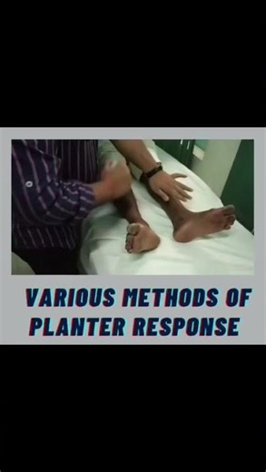 Planter Reflex methods | Oppenheim method | Gorden Method #planterreflex #neurologicalexamination