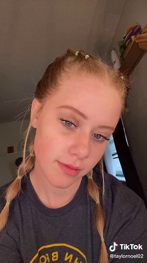 The Healing Process of a Black Eye Over 4 Weeks