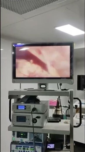 Massive hemoperitoneum RUPTURED ECTOPIC PREGNANCY