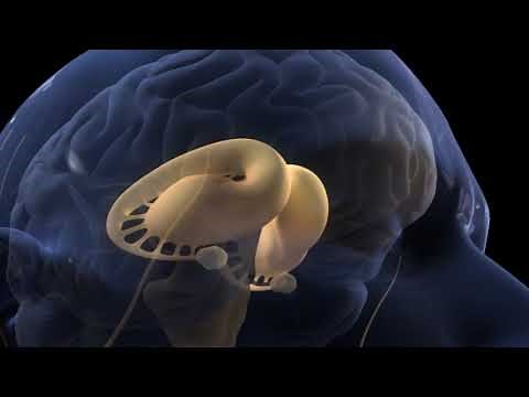 Pain Perception and the Human Brain