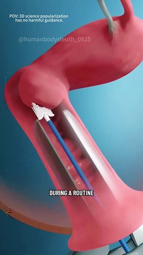 How Pap Smear Test Is Performed (3D Animation) #3dmedicalanimation #medical3danimation #papsmear #papsmeartest #pelvichealth