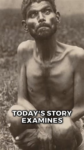 The boy raised by wolves | History In Pictures