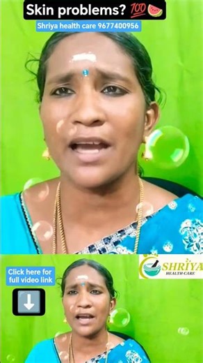 Skin problems? 💯🍉 #shorts #viral #trending #health #skin #skinproblems #naturopathy #tips #tamil