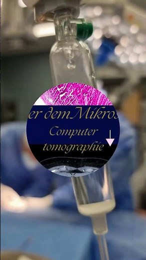 Blinddarm: Kleines Organ, große Gefahr