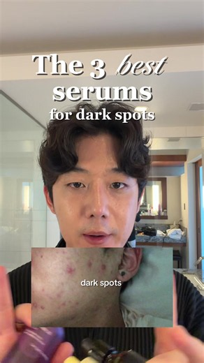If you are struggling with your dark spots you need to try these 3 serums. Perfect for fading stubborn hyperpigmentation and post acne marks 🌟 @manyo Glutathione 7 Dark Spot Serum 💧 @dear, Klairs EGF Blue Youth Activating Drop 🪻 @Jumiso Global Niacinamide 20 Serum #acneproneskin #acnescaring #darkspotserum #acne #skintok