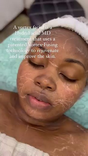 Hydra facial in ELDORET .OFFER PRICE 7500Ksh Cleanses and nourishes at same time @dr_facekenya ….... Stimulates Circulation. .. For inquiries and appointments Call 0710472946,ELDORET Good salon in Eldoret For brows and lashes @brow_refit LIKE✅ COMMENT📝SHARE👭SAVE📩 Book appointments ☎️Call 0710472946 DM/Text Visit us @Zionmall 1st Floor For salon and barbershop in Eldoret. We are here for you ... Massage ,dreadlocks ,gelpolish Makeup.microshading ,sisterlocks Hair colouring ,bridal styling .eye