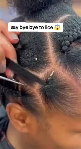 Effective Ways to Say Bye Bye to Lice