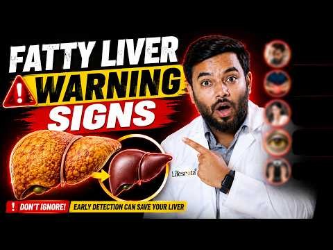 Fatty Liver Symptoms: 6 Warning Signs You Shouldn’t Ignore!