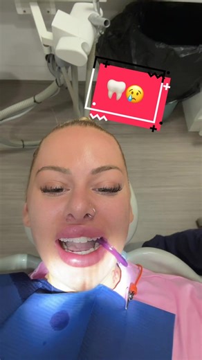 Réparation de ma dent cassée : Mon expérience