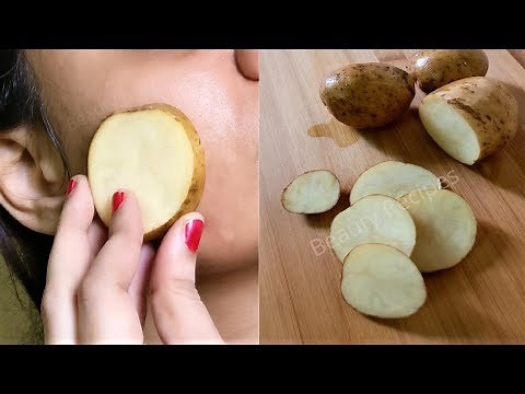 i rub Potato on my face & it removed my Dark spots and hyperpigmentation in 30 days