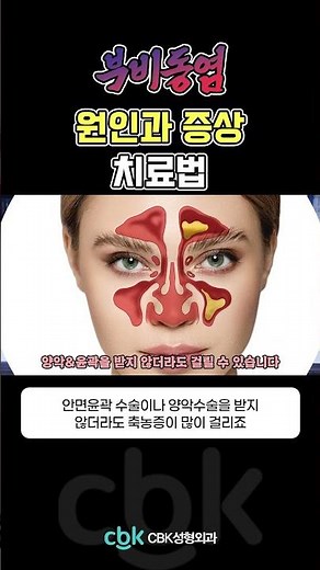 양악수술 부작용? 15년 고정핀제거 부비동염(축농증) 치료 후기 両顎手術の副作用？15年物の固定ピン除去、副鼻腔炎（ちくのう症）