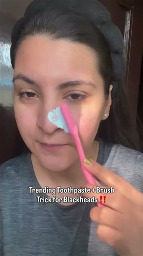 Removing Blackheads at Home Using Toothpaste & Brush | Viral Hack Tested