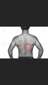 Prolonged Thoracic Stiffness/Pain